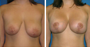 Before & After Photos